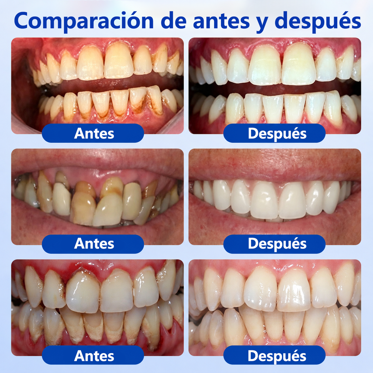 🦷𝑮𝒍𝒊𝒎𝒎𝒆𝒓𝒍𝒚® 𝑮𝒖𝒎𝑹𝒆𝒗𝒊𝒗𝒆 𝑮𝒆𝒍 𝑹𝒆𝒑𝒂𝒓𝒂𝒅𝒐𝒓 𝑷𝒆𝒓𝒊𝒐𝒅𝒐𝒏𝒕𝒂𝒍 🧸