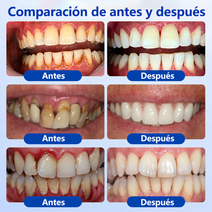 🦷𝑮𝒍𝒊𝒎𝒎𝒆𝒓𝒍𝒚® 𝑮𝒖𝒎𝑹𝒆𝒗𝒊𝒗𝒆 𝑮𝒆𝒍 𝑹𝒆𝒑𝒂𝒓𝒂𝒅𝒐𝒓 𝑷𝒆𝒓𝒊𝒐𝒅𝒐𝒏𝒕𝒂𝒍 🧸