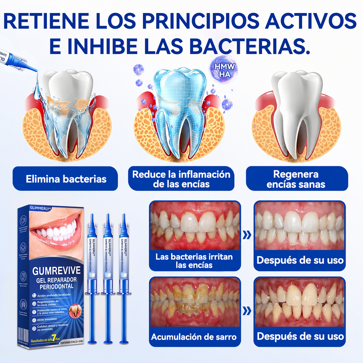 🦷𝑮𝒍𝒊𝒎𝒎𝒆𝒓𝒍𝒚® 𝑮𝒖𝒎𝑹𝒆𝒗𝒊𝒗𝒆 𝑮𝒆𝒍 𝑹𝒆𝒑𝒂𝒓𝒂𝒅𝒐𝒓 𝑷𝒆𝒓𝒊𝒐𝒅𝒐𝒏𝒕𝒂𝒍 🧸
