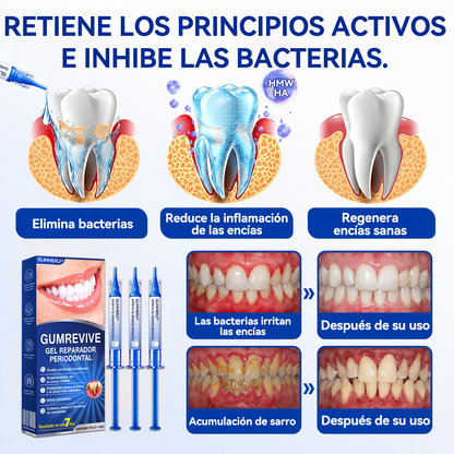 🦷𝑮𝒍𝒊𝒎𝒎𝒆𝒓𝒍𝒚® 𝑮𝒖𝒎𝑹𝒆𝒗𝒊𝒗𝒆 𝑮𝒆𝒍 𝑹𝒆𝒑𝒂𝒓𝒂𝒅𝒐𝒓 𝑷𝒆𝒓𝒊𝒐𝒅𝒐𝒏𝒕𝒂𝒍 🧸