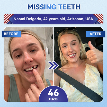 𝐆𝐥𝐢𝐦𝐦𝐞𝐫𝐥𝐲® 🦷 Parche de microagujas con Tideglusib para la reparación de dientes y encías  3.0