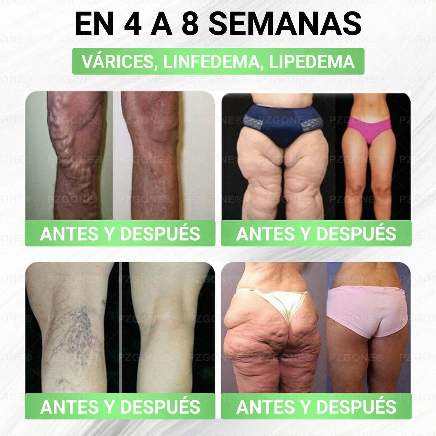 𝑳𝒖𝒙𝒂𝒓𝒊𝒔𝒆 ✅ Moringa & Berberina 10 en 1 Parche Avanzado de Microagujas Nano (Uso diario, cambios visibles en 7 días) 👩‍⚕️ Obesidad, Diabetes, Apnea del Sueño y Problemas Articulares