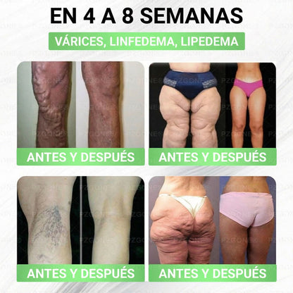 𝑳𝒖𝒙𝒂𝒓𝒊𝒔𝒆 ✅ Moringa & Berberina 10 en 1 Parche Avanzado de Microagujas Nano (Uso diario, cambios visibles en 7 días) 👩‍⚕️ Obesidad, Diabetes, Apnea del Sueño y Problemas Articulares