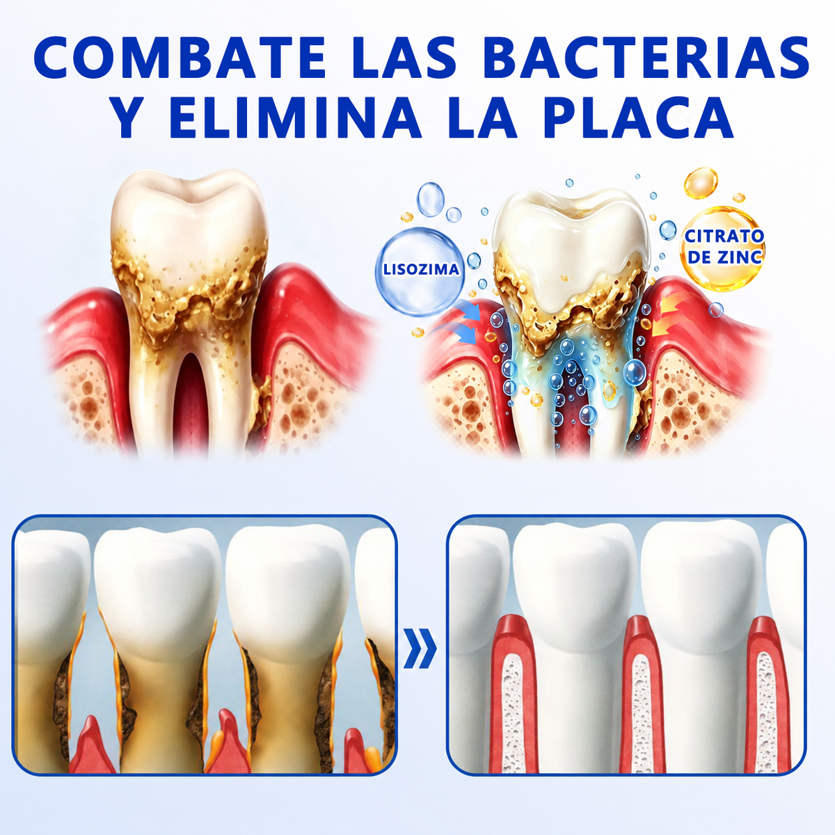 🦷𝑮𝒍𝒊𝒎𝒎𝒆𝒓𝒍𝒚® 𝑮𝒖𝒎𝑹𝒆𝒗𝒊𝒗𝒆 𝑮𝒆𝒍 𝑹𝒆𝒑𝒂𝒓𝒂𝒅𝒐𝒓 𝑷𝒆𝒓𝒊𝒐𝒅𝒐𝒏𝒕𝒂𝒍 🧸