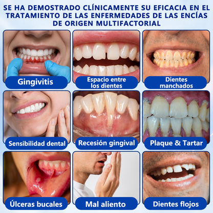 🦷𝑮𝒍𝒊𝒎𝒎𝒆𝒓𝒍𝒚® 𝑮𝒖𝒎𝑹𝒆𝒗𝒊𝒗𝒆 𝑮𝒆𝒍 𝑹𝒆𝒑𝒂𝒓𝒂𝒅𝒐𝒓 𝑷𝒆𝒓𝒊𝒐𝒅𝒐𝒏𝒕𝒂𝒍 🧸