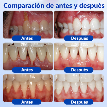 🦷𝑮𝒍𝒊𝒎𝒎𝒆𝒓𝒍𝒚® 𝑮𝒖𝒎𝑹𝒆𝒗𝒊𝒗𝒆 𝑮𝒆𝒍 𝑹𝒆𝒑𝒂𝒓𝒂𝒅𝒐𝒓 𝑷𝒆𝒓𝒊𝒐𝒅𝒐𝒏𝒕𝒂𝒍 🧸